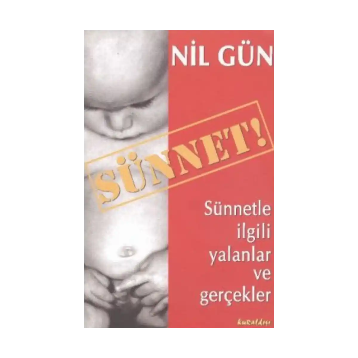 a0c5c-sunnet-1-1.webp Sünnet - Görsel 1